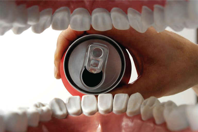Effects of drinking soda on your teeth